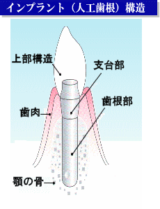 image-kouzou
