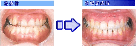 image-3